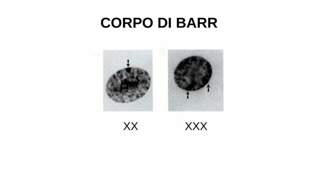 corpo di Barr