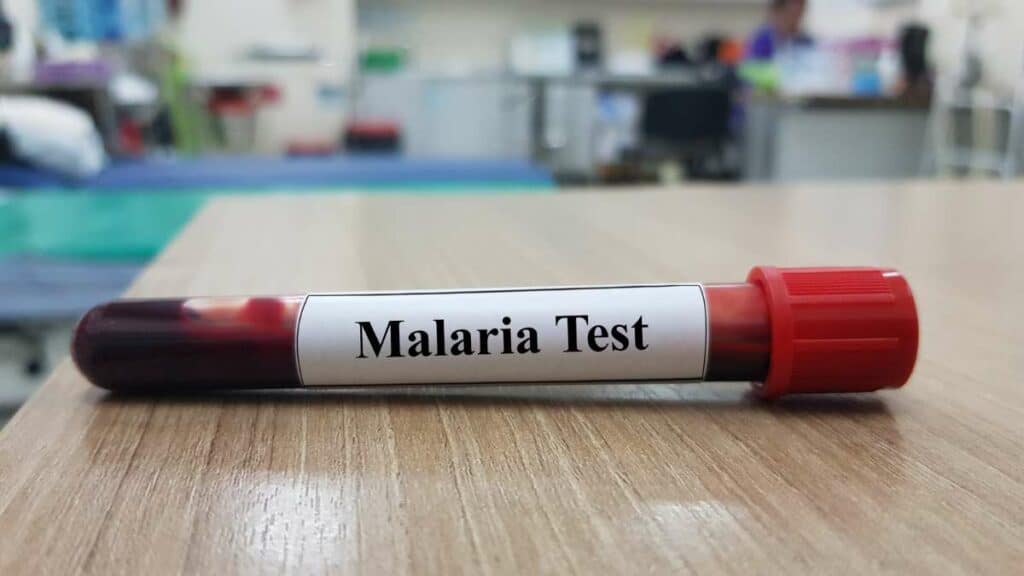 plasmodium falciparum - parassita malaria