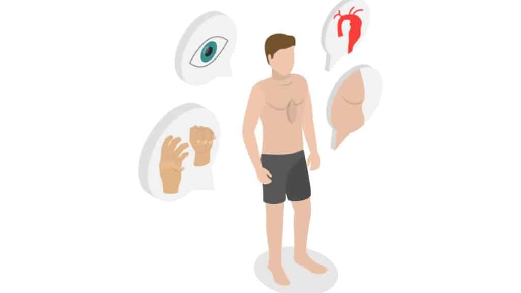 Sindrome di Marfan - guida completa per studenti di medicina
