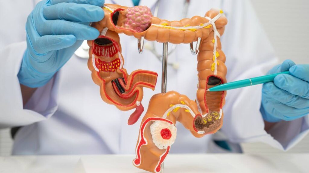 Colon - struttura, funzioni e vascolarizzazione anatomica